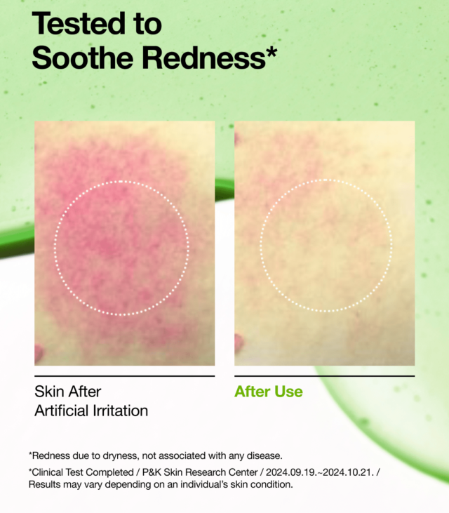 Anua azelaic 10 + Hyaluron Redness Soothing Serum - Image 4