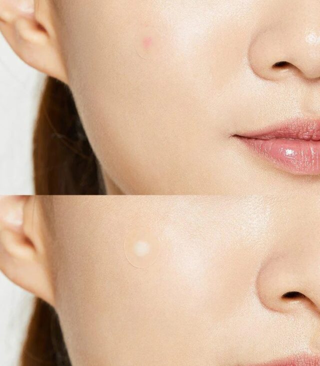 Cosrx Acne Pimple Master Patch - Image 4