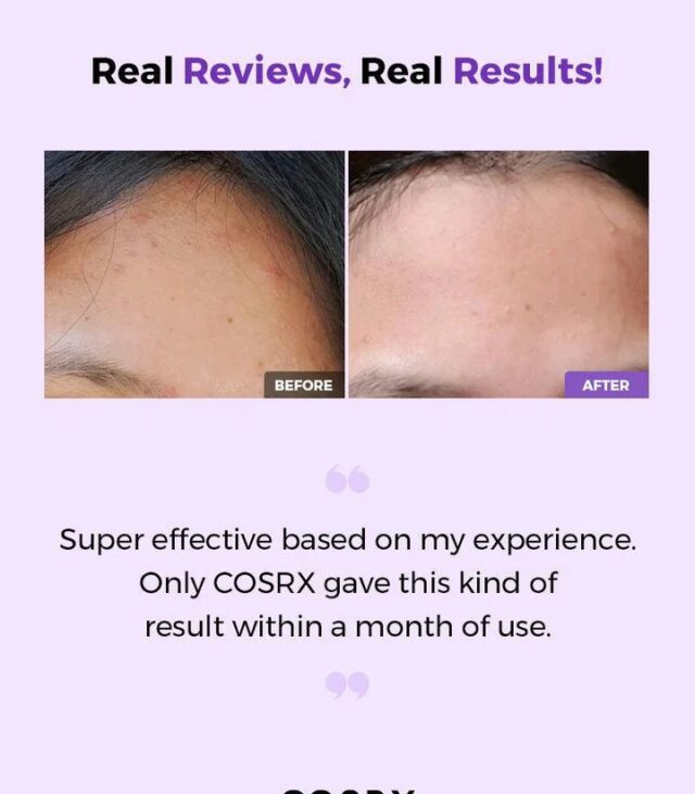 COSRX AHA/BHA Clarifying Treatment Toner - Image 6